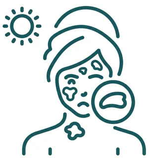 Hyperpigmentation (Melasma)