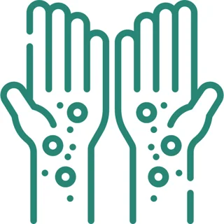 Atopic Dermatitis